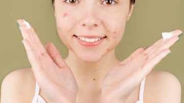 Trądzik młodzieńczy – jakie kosmetyki mogą pomóc nastolatkom